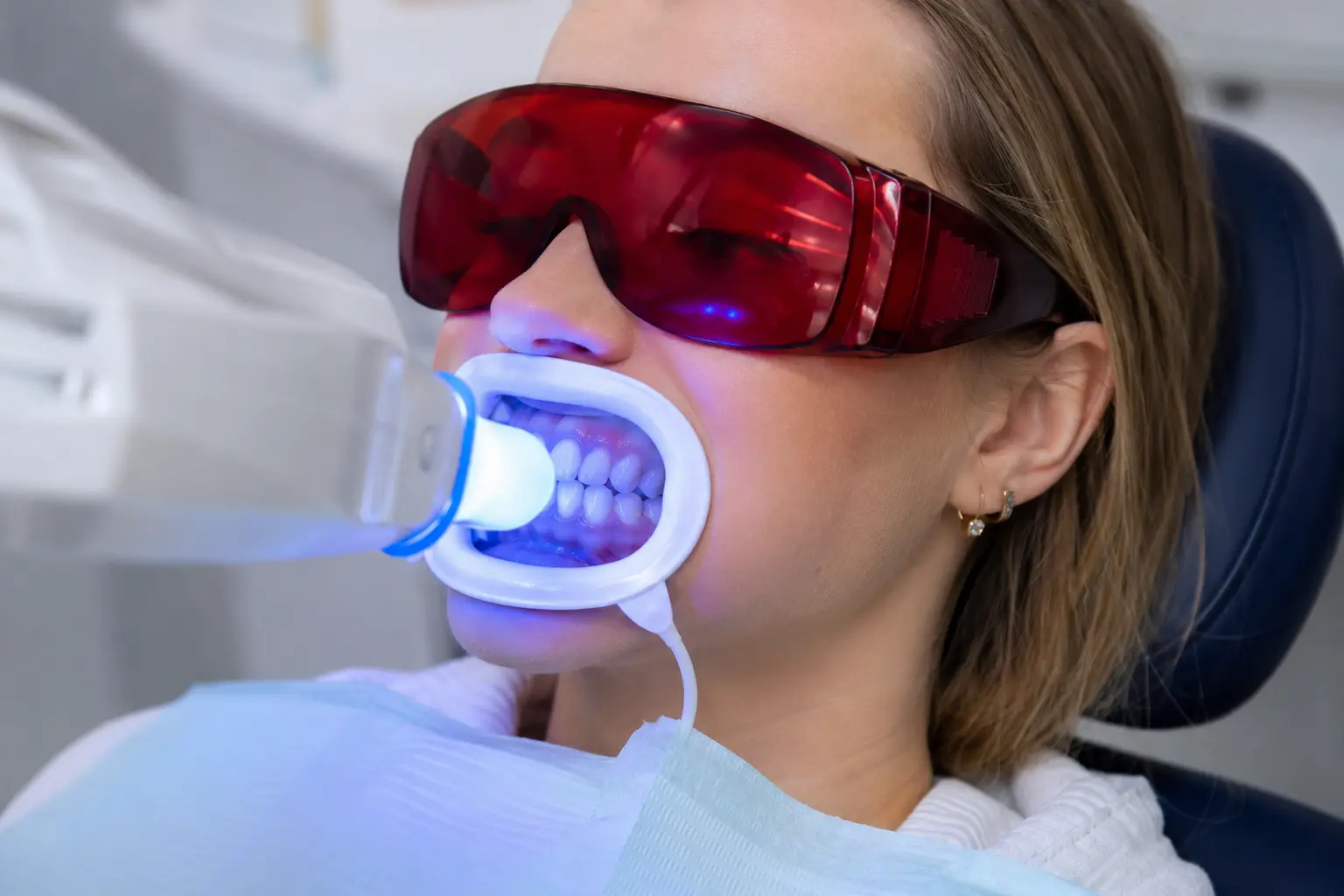 In-chair teeth whitening in Ivanhoe