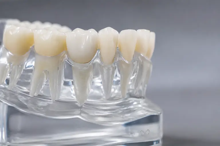Dental crown in Ivanhoe